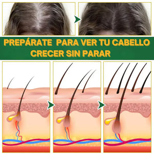 OUHOE -CRECIMIENTO DE CABELLO